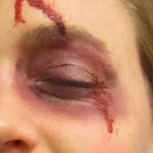 Black eye. Maybe.