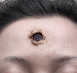 Bullet wound. Apparently. Bullet wound. Apparently.